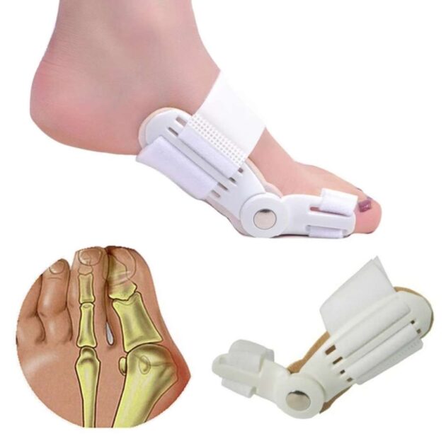 اعوجاج اصبع القدم